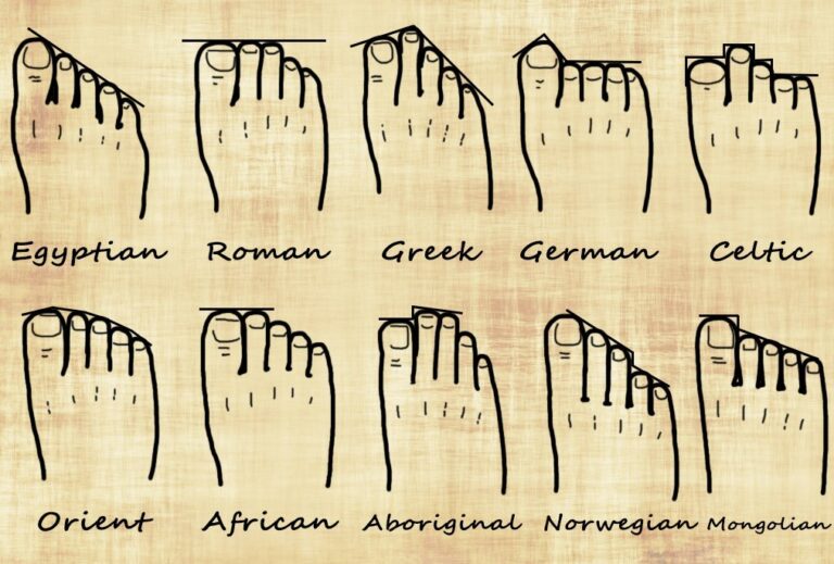 Do you have “Greek Feet”? Sports and Structural Podiatry Maroochydore